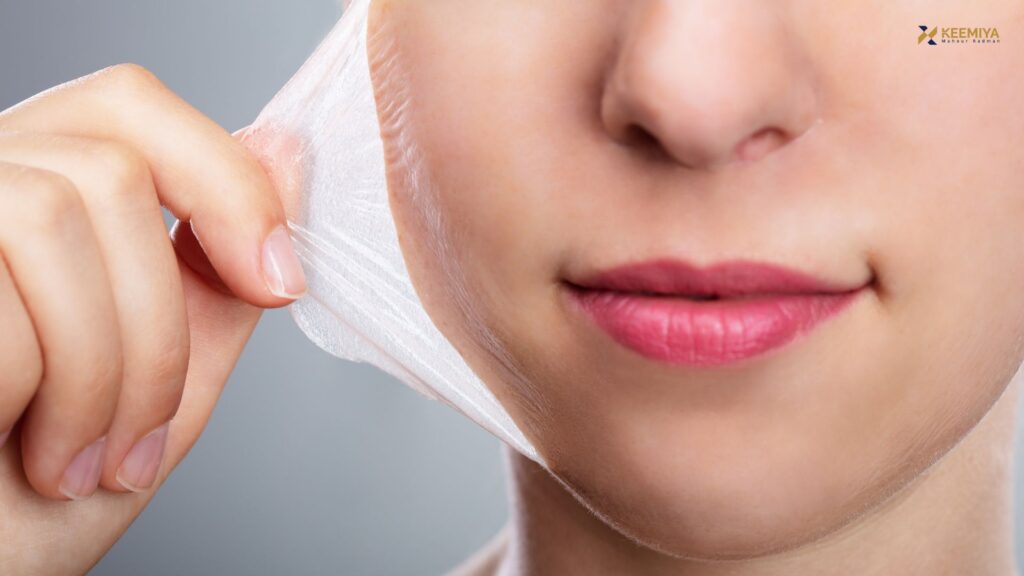 enzymatic skin peeling